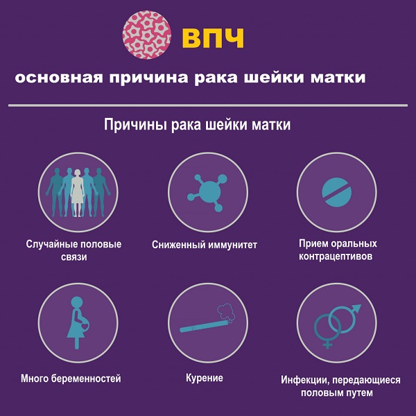 ВПЧ